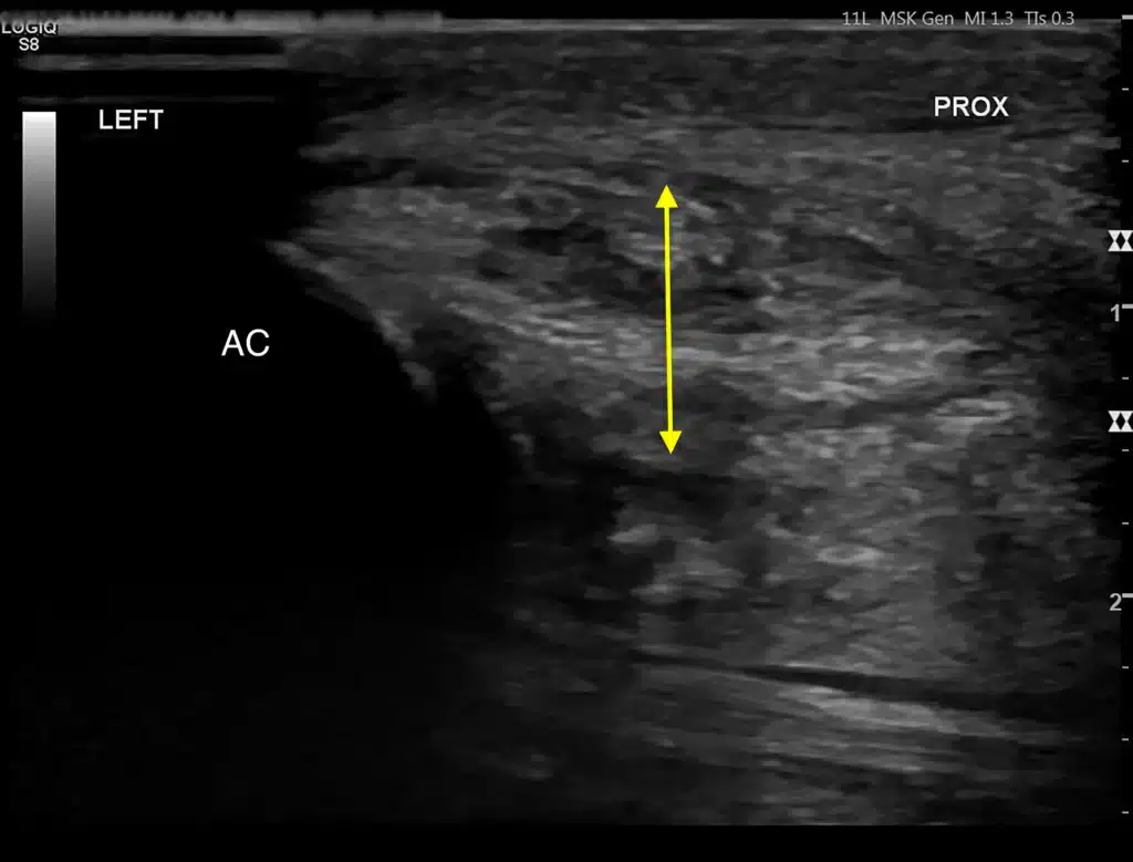 Tendon injury in dogs 6 Figure 3A