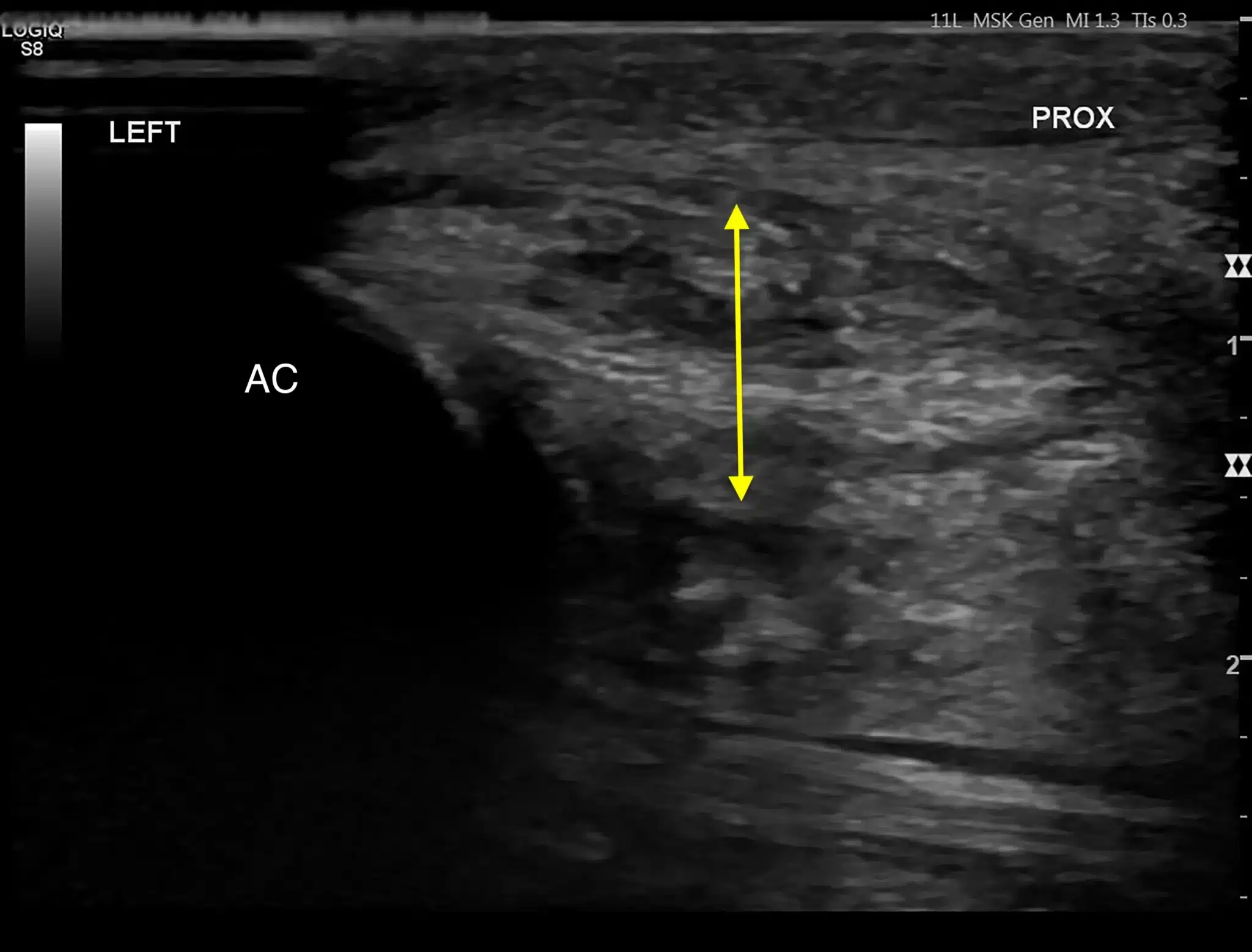 Tendon injury in dogs 8 Ultrasound image of tendon