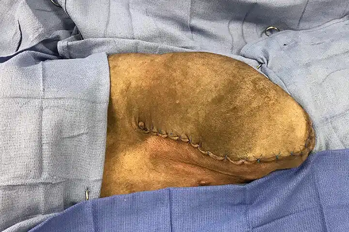Leg amputation in dogs 15 ProP Pelvic Limb Step 14
