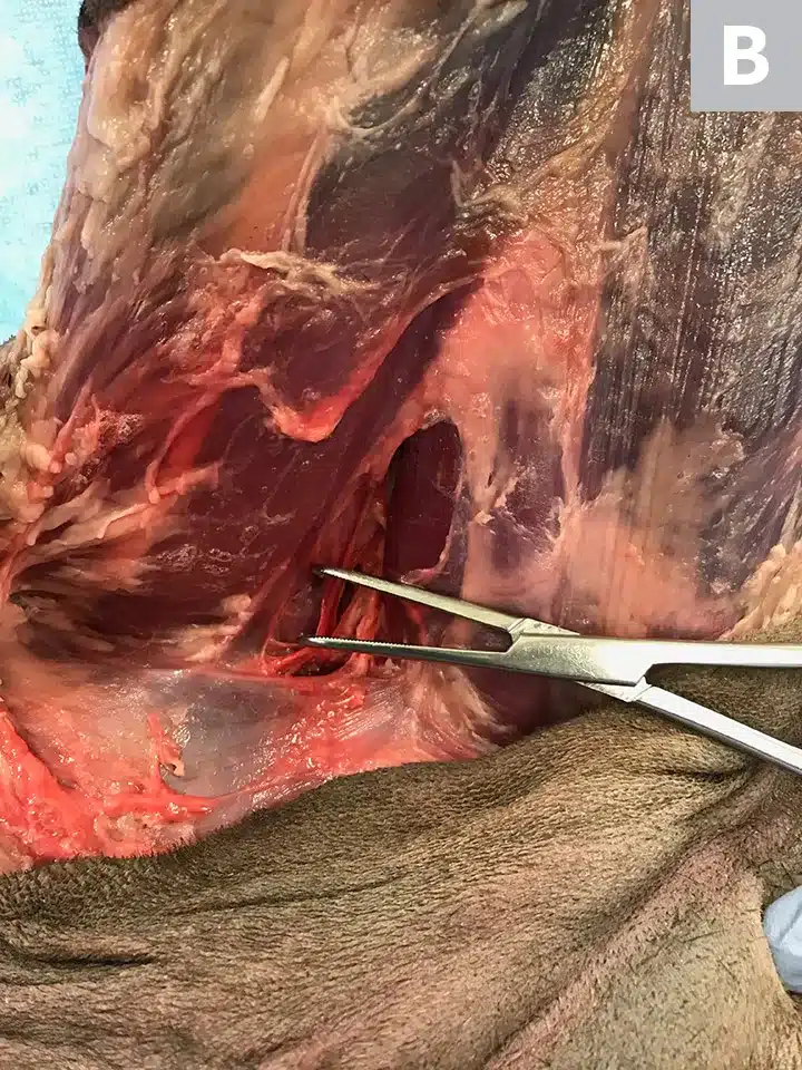 Leg amputation in dogs 4 ProP Pelvic Limb Step 3B